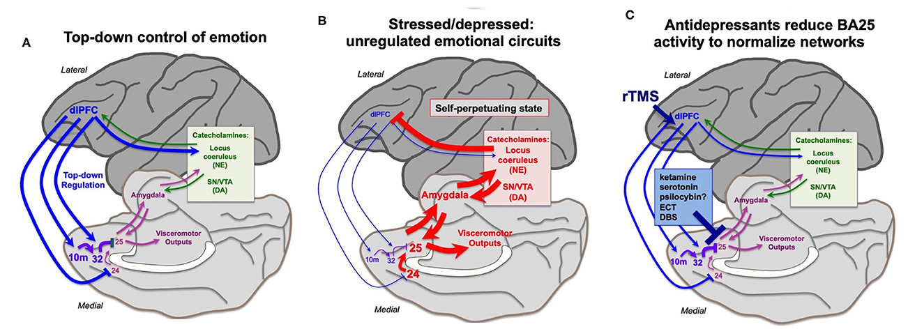 Example of dlPFC dichotomy